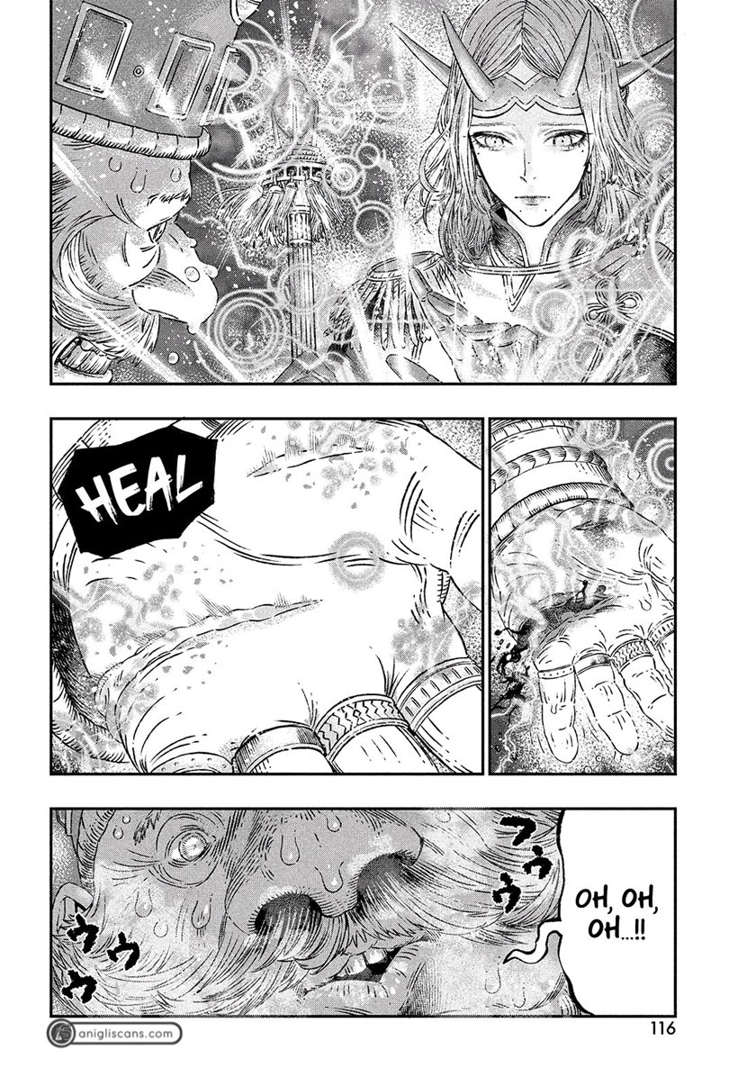 Koudo ni Hattatsu Shita Igaku wa Mahou to Kubetsu ga Tsukanai ANAFILAKSIS DAN ANTIGEN 第18页